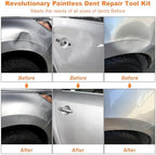 135pcs Dent Puller Kit, Paintless Dent Removal Kit for Dent Repair, Car Dent Repair Kit with T-Bar, Bridge Puller, Golden Lifter, Car Dent Remover for Car Refrigerator Door Ding Repair - Image 2